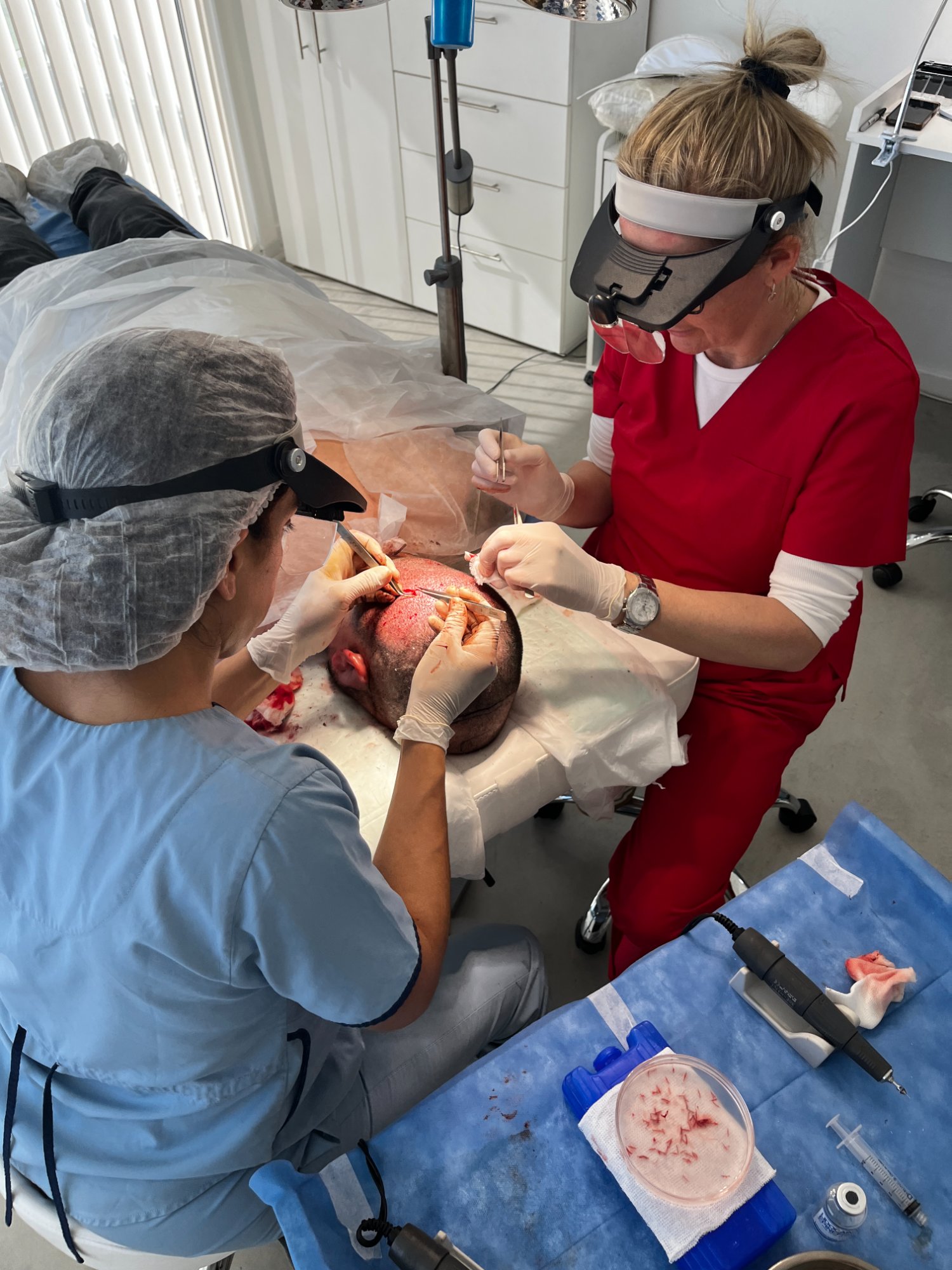 Implante Capilar FUE-DHI